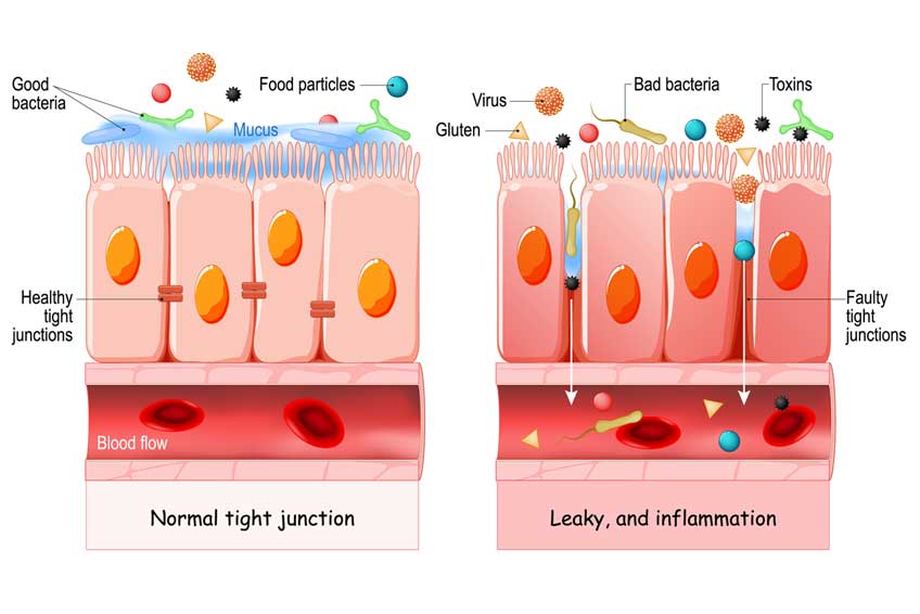 How To Detox Your Gut Daily